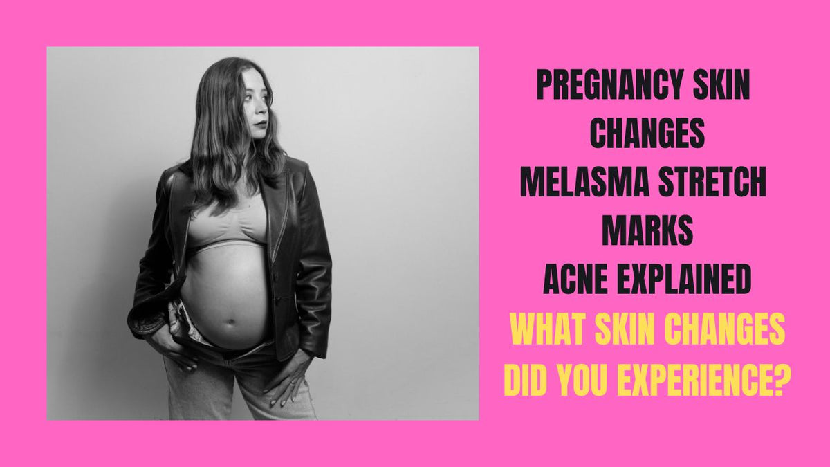 Pregnancy Skin Changes Melasma, Stretch Marks, Acne Explained