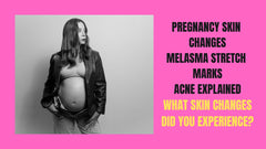 Pregnancy Skin Changes Melasma, Stretch Marks, Acne Explained